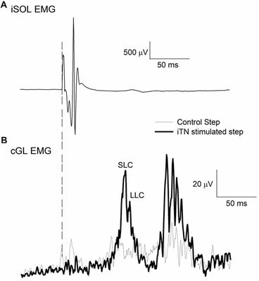 Evidence for a Supraspinal Contribution to the Human Crossed Reflex Response During Human Walking